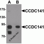 Western blot analysis of CCDC141 in SK-N-SH cell tissue lysate with CCDC141 antibody at 1 μg/mL in (A) the absence and (B) the presence of blocking peptide.