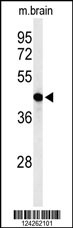 AGPAT6 Antibody
