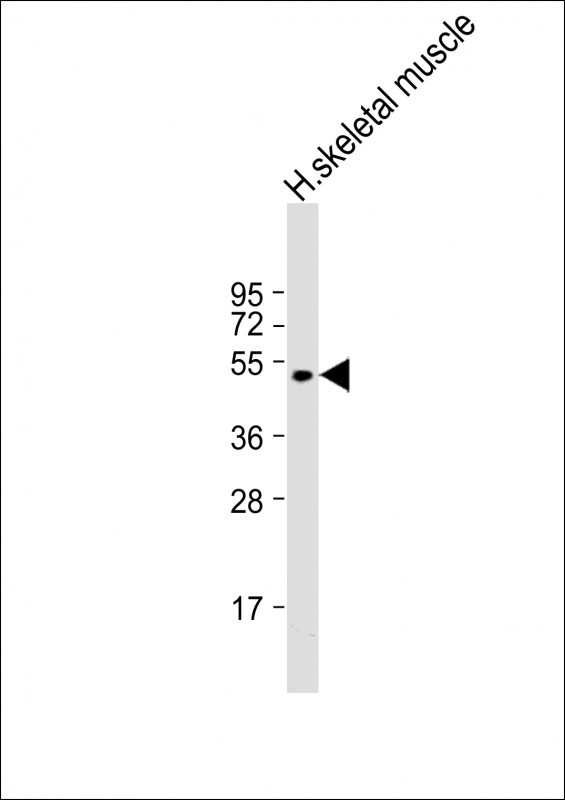 ZDHHC9 Antibody