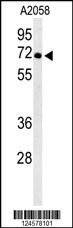 ATP6V1A Antibody