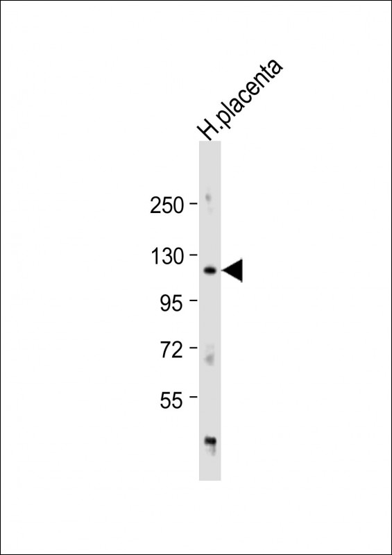 ADAM19 Antibody