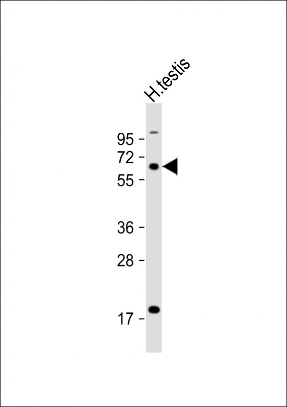 ACBG2 Antibody