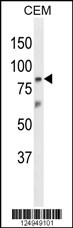 ZN160 Antibody