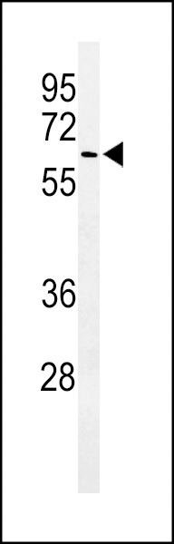 ALG10 Antibody