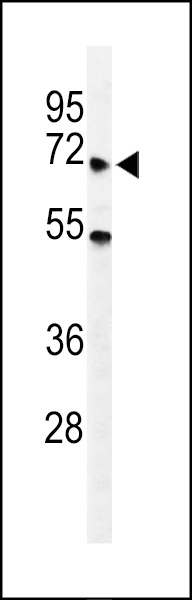 YTHD3 Antibody