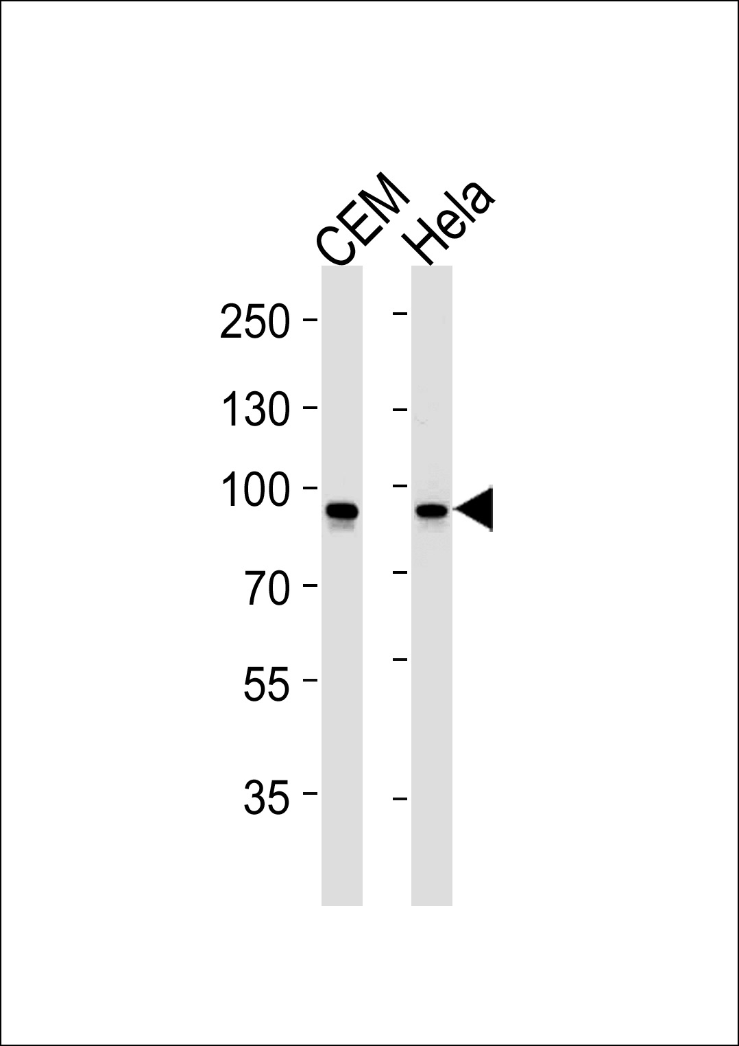 STAT1 Antibody [1141CT26.2.1]
