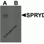Western blot analysis of SPRYD3 in human brain tissue lysate with SPRYD3 antibody at 1 μg/mL in (A) the absence and (B) the presence of blocking peptide.