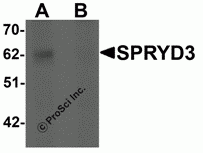 SPRYD3 Peptide