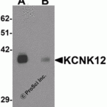 Western blot analysis of KCNK12 in rat brain tissue lysate with KCNK12 antibody at 0.5 μg/mL in (A) the absence and (B) the presence of blocking peptide.