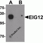 Western blot analysis of EIG121 in MCF7 cell lysate with EIG121 antibody at 1 μg/mL in (A) the absence and (B) the presence of blocking peptide.