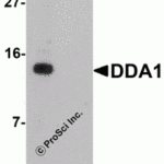 Western blot analysis of DDA1 in mouse heart tissue lysate with DDA1 antibody at 1 μg/mL in (A) the absence and (B) the presence of blocking peptide.