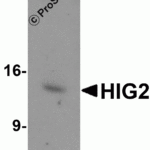 Western blot analysis of HIG2 in 3T3 cell lysate with HIG2 antibody at 1 μg/mL in (A) the absence and (B) the presence of blocking peptide.