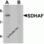Western blot analysis of SDHAF2 in rat liver tissue lysate with SDHAF2 antibody at 1 μg/mL in (A) the absence and (B) the presence of blocking peptide.