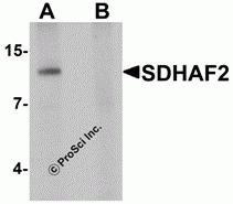 SDHAF2 Peptide