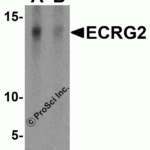 Western blot analysis of ECRG2 in human lung tissue lysate with ECRG2 antibody at 1 μg/mL in (A) the absence and (B) the presence of blocking peptide.