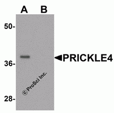 PRICKLE4 Peptide