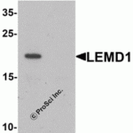 Western blot analysis of LEMD1 in A20 cell lysate with LEMD1 antibody at 1 µg/ml in (A) the absence and (B) the presence of blocking peptide.