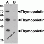Western blot analysis of Thymopoietin in HeLa cell lysate with Thymopoietin antibody at 0.25 μg/mLl in (A) the absence and (B) the presence of blocking peptide.
