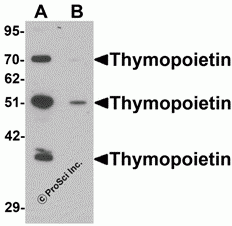 Thymopoietin Peptide