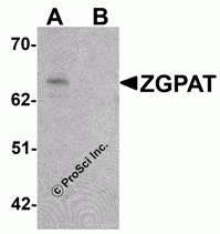 ZGPAT Peptide