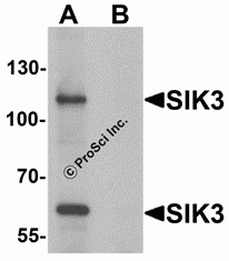 SIK3 Peptide
