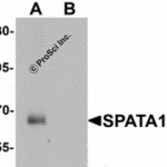 Western blot analysis of SPATA18 in rat lung tissue lysate with SPATA18 antibody at 1 μg/mL in (A) the absence and (B) the presence of blocking peptide.