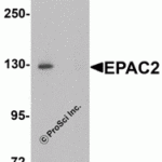 Western blot analysis of EPAC2 in rat liver tissue lysate with EPAC2 antibody at 1 μg/mL in (A) the absence and (B) the presence of blocking peptide.