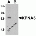 Western blot analysis of KPNA6 in EL4 cell lysate with KPNA5 antibody at 1 μg/mL in (A) the absence and (B) the presence of blocking peptide.