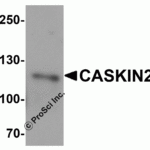 Western blot analysis of CASKIN2 in Hela cell lysate with CASKIN2 antibody at 1 μg/mL in (A) the absence and (B) the presence of blocking peptide.
