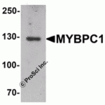 Western blot analysis of KPNA6 in EL4 cell lysate with KPNA5 antibody at 1 μg/mL in (A) the absence and (B) the presence of blocking peptide.