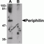 Western blot analysis of JMJD3 in K562 cell lysate with JMJD3 antibody at 0.5 μg/mL in (A) the absence and (B) the presence of blocking peptide.
