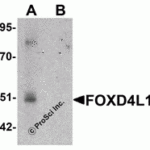 Western blot analysis of CASKIN2 in Hela cell lysate with CASKIN2 antibody at 1 μg/mL in (A) the absence and (B) the presence of blocking peptide.