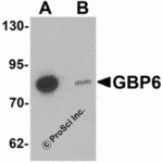 Western blot analysis of GBP6 in Hela cell lysate with GBP6 antibody at 0.5 μg/mL in (A) the absence and (B) the presence of blocking peptide.