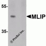 Western blot analysis of MLIP in 293 cell lysate with MLIP antibody at 1 μg/mL in (A) the absence and (B) the presence of blocking peptide.