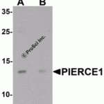 Western blot analysis of PIERCE1 in A20 cell lysate with PIERCE1 antibody at 1 μg/mL in (A) the absence and (B) the presence of blocking peptide.