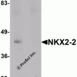 Western blot analysis of NKX2-2 in rat kidney tissue lysate with NKX2-2 antibody at 1 μg/mL in (A) the absence and (B) the presence of blocking peptide.
