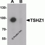 Western blot analysis of TSHZ1 in A-20 cell lysate with TSHZ1 antibody at 1 μg/mL in (A) the absence and (B) the presence of blocking peptide.