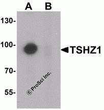 TSHZ1 Peptide
