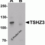 Western blot analysis of TSHZ3 in mouse brain tissue lysate with TSHZ3 antibody at 1 μg/mL in (A) the absence and (B) the presence of blocking peptide.