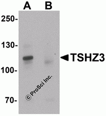 TSHZ3 Peptide