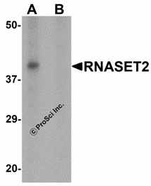 RNASET2 Peptide