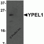 Western blot analysis of YPEL1 in Hela cell lysate with YPEL1 antibody at 1 μg/mL in (A) the absence and (B) the presence of blocking peptide.