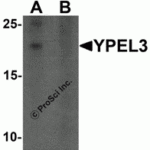 Western blot analysis of YPEL3 in A-20 cell lysate with YPEL3 antibody at 1 μg/mL in (A) the absence and (B) the presence of blocking peptide