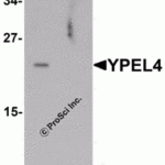 Western blot analysis of YPEL4 in SW480 cell lysate with YPEL4 antibody at 1 μg/mL in (A) the absence and (B) the presence of blocking peptide.