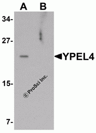 YPEL4 Peptide