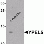Western blot analysis of YPEL5 in A-20 cell lysate with YPEL5 antibody at 1 μg/mL in (A) the absence and (B) the presence of blocking peptide.