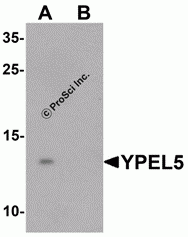 YPEL5 Peptide