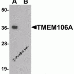 Western blot analysis of TMEM106A in A-20 cell lysate with TMEM106A antibody at 1 μg/mL in (A) the absence and (B) the presence of blocking peptide.