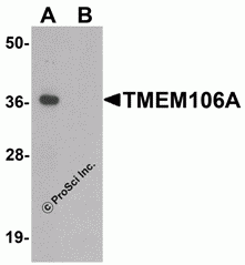 TMEM106A Peptide