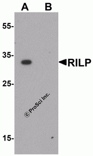 RILP Peptide